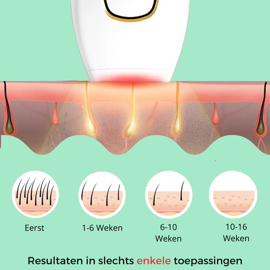 IPL Haar Verwijderaar | Laserontahring voor Thuis